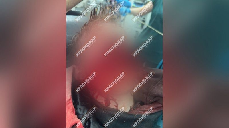 СК возбудил уголовное дело после нападения домашних собак на ребенка в Сочи