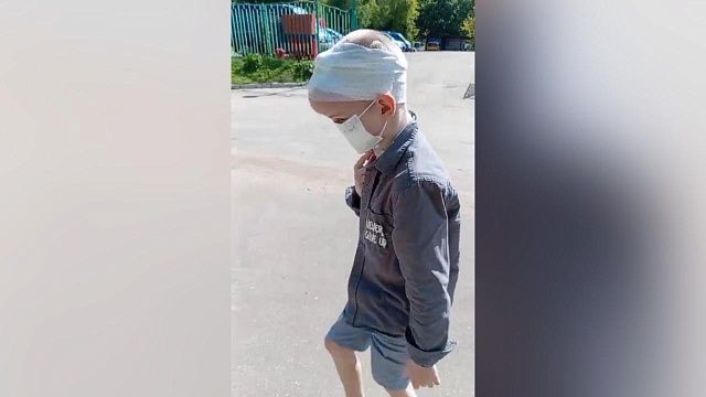 Отец пострадавшего от нападения хаски сочинца рассказал о состоянии сына