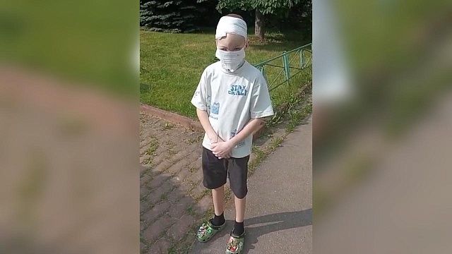 Новую операцию искусанному хаски мальчику из Сочи проведут в середине июля