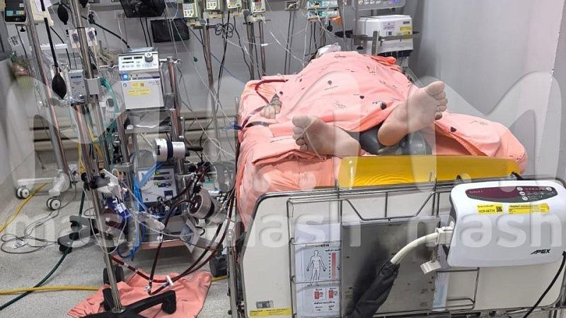 Родственники Паши Техника сообщили, что артист пережил клиническую смерть