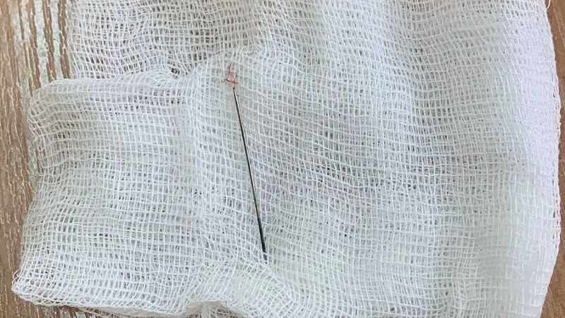 Пожилой пациентке вытащили иглу из нёба на Кубани 