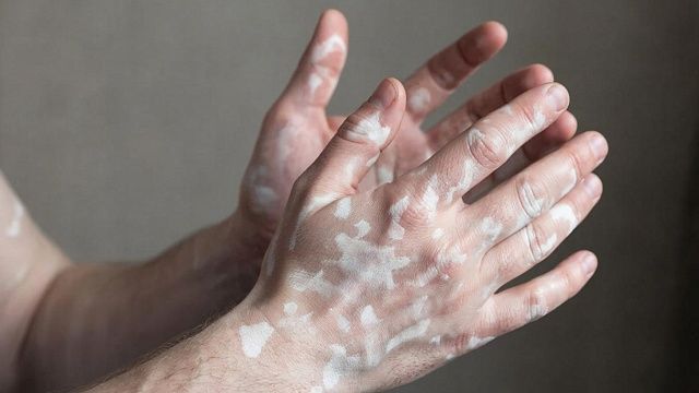 Изображение создано при помощи ИИ. 