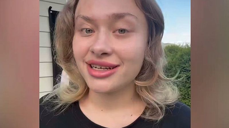 Шрам на пол-лица показала покалеченная украинская модель Ковальчук