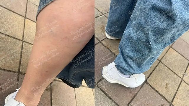 Появились кадры последствия нападения собаки на женщину в Краснодаре