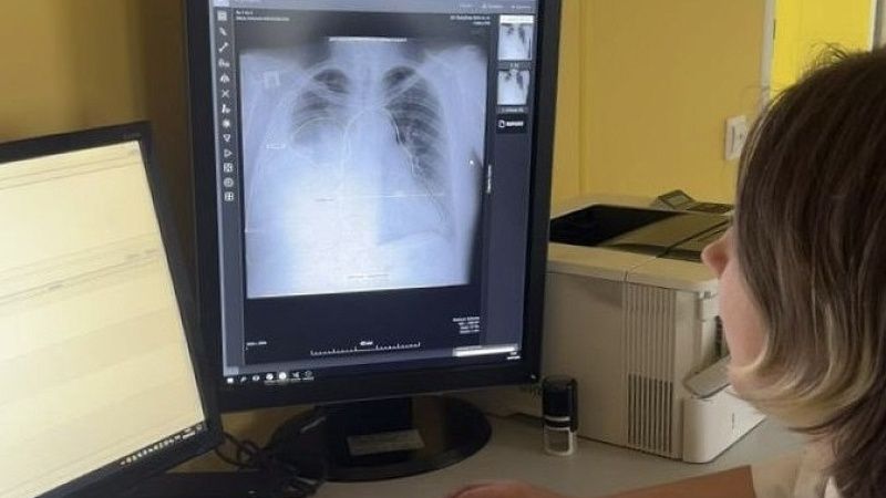 Искусственный интеллект обработал более 300 рентгеновских снимков на Кубани