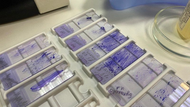 Уникальную капсулу для раннего выявления рака пищевода создали в России