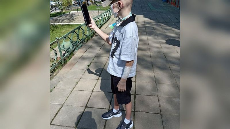 Врачи снова прооперируют нос пострадавшему от собак мальчику из Сочи