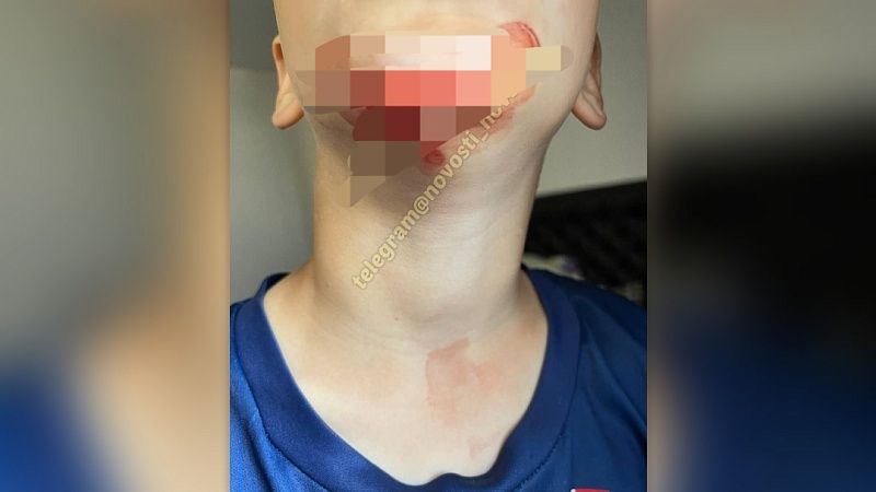 Школьница чуть не задушила во время игры ребёнка в Новороссийске 