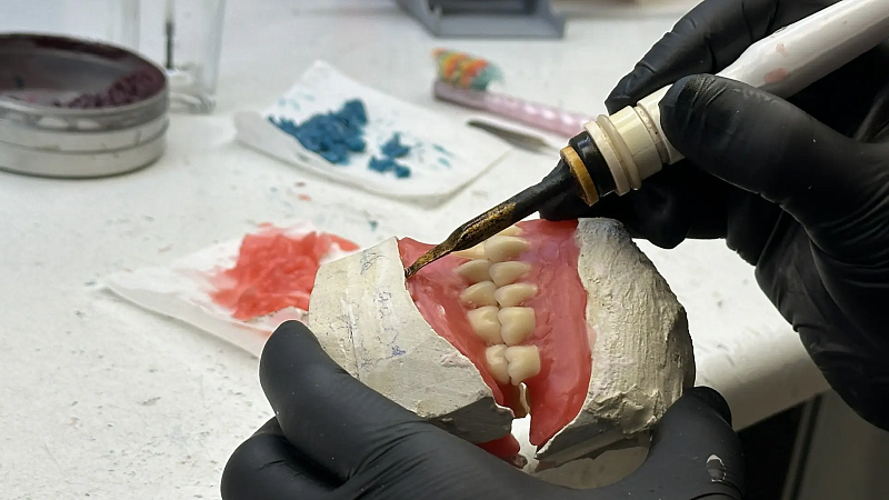 Пациентке без показаний удалили 11 здоровых зубов в Италии