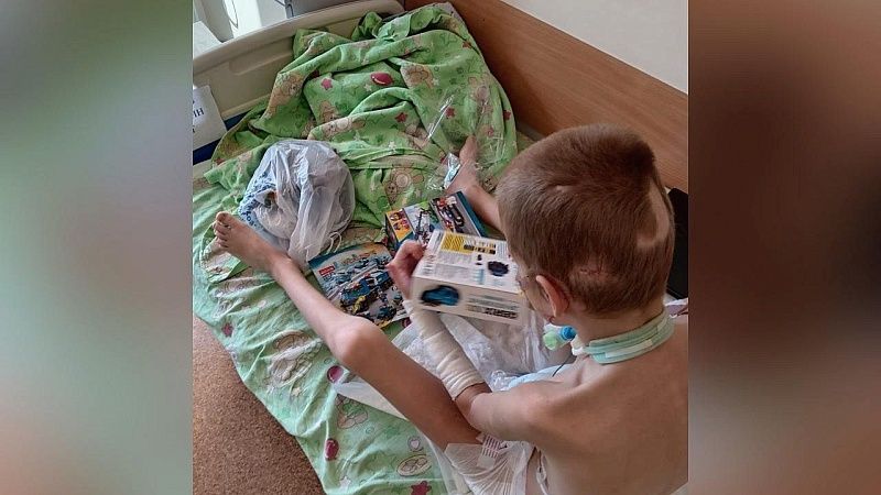 Отец сообщил о состоянии после повторного приживления лоскута у ребёнка из Сочи